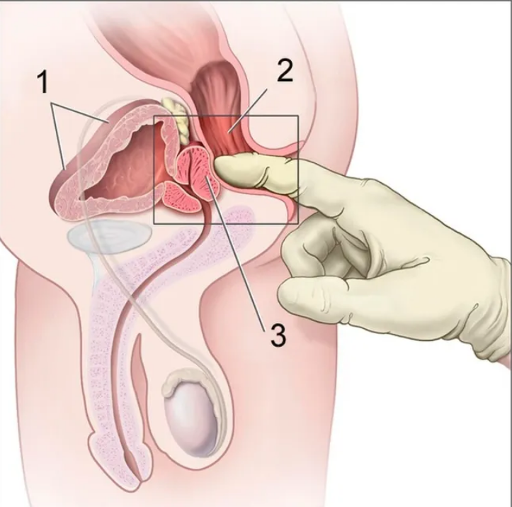 What Happens When You Go Further Back; Prostate Play In A Chastity Device